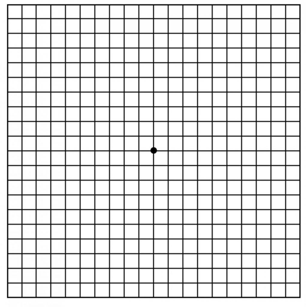 Macular Degeneration Using Amsler Grid Www scottsdaleeye