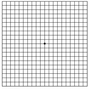 Macular Degeneration: Using Amsler Grid – www.scottsdaleeye.com